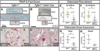 TGF-β signaling in the cranial neural crest affects late-stage mandibular bone resorption and length